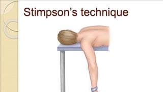 Dislocation of shoulder мөрний мултрал