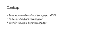 Хэлбэр
• Anterior хамгийн элбэг тохиолддог >95 %
• Posterior <5% бага тохиолддог
• Inferior <1% маш бага тохиолддог
 