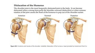 Dislocation of shoulder мөрний мултрал