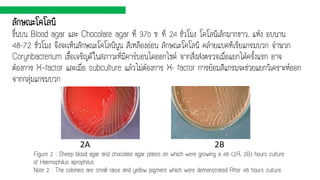 ลักษณะโคโลนี
ขึ้นบน Blood agar และ Chocolate agar ที่ 37o ซ. ที่ 24 ชั่วโมง โคโลนีเล็กมากขาว, แห้ง อบนาน
48-72 ชั่วโมง จึงจะเห็นลักษณะโคโลนีนูน สีเหลืองอ่อน ลักษณะโคโลนี คล้ายแบคทีเรียแกรมบวก จาพวก
Corynbacterium เชื้อเจริญดีในสภาวะที่มีคาร์บอนไดออกไซด์ จากสิ่งส่งตรวจเมื่อแยกได้ครั้งแรก อาจ
ต้องการ X–factor และเมื่อ subculture แล้วไม่ต้องการ X- factor การย้อมสีแกรมจะช่วยแยกวิเคราะห์ออก
จากกลุ่มแกรมบวก
Figure 2 : Sheep blood agar and chocolate agar plates on which were growing a 48 (2A, 2B) hours culture
of Haemophilus aprophilus.
Note 2 : The colonies are small raise and yellow pigment which were demonstrated After 48 hours culture.
2A 2B
 