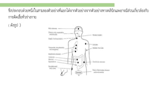 ซึ่งประกอบด้วยหนึ่งในสามของตัวอย่างที่แยกได้จากตัวอย่างจากตัวอย่างทางคลินิกและอาจมีส่วนเกี่ยวข้องกับ
การติดเชื้อทั่วร่างกาย
( ดังรูป )
 