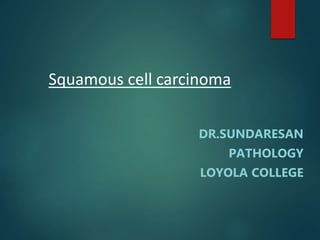 Squamous cell carcinoma
DR.SUNDARESAN
PATHOLOGY
LOYOLA COLLEGE
 