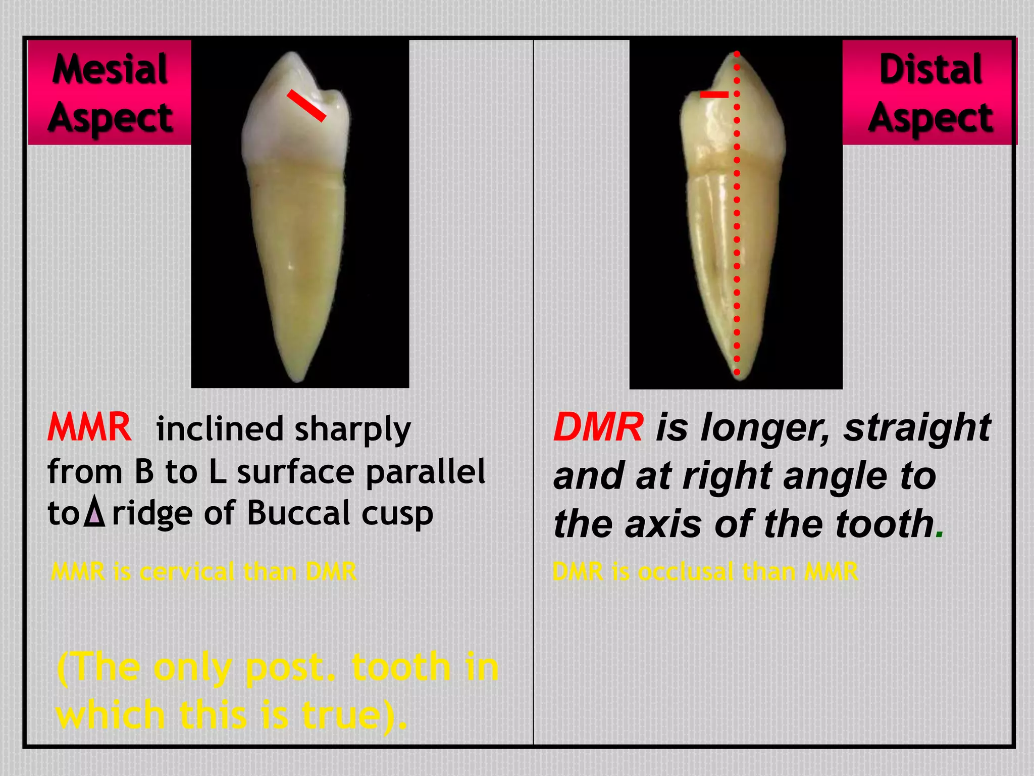 DMR is longer, straight
and at right angle to
the axis of the tooth.
(The only post. tooth in
which this is true).
MMR inclined sharply
from B to L surface parallel
to ridge of Buccal cusp
Mesial
Aspect
Distal
Aspect
DMR is occlusal than MMRMMR is cervical than DMR
 