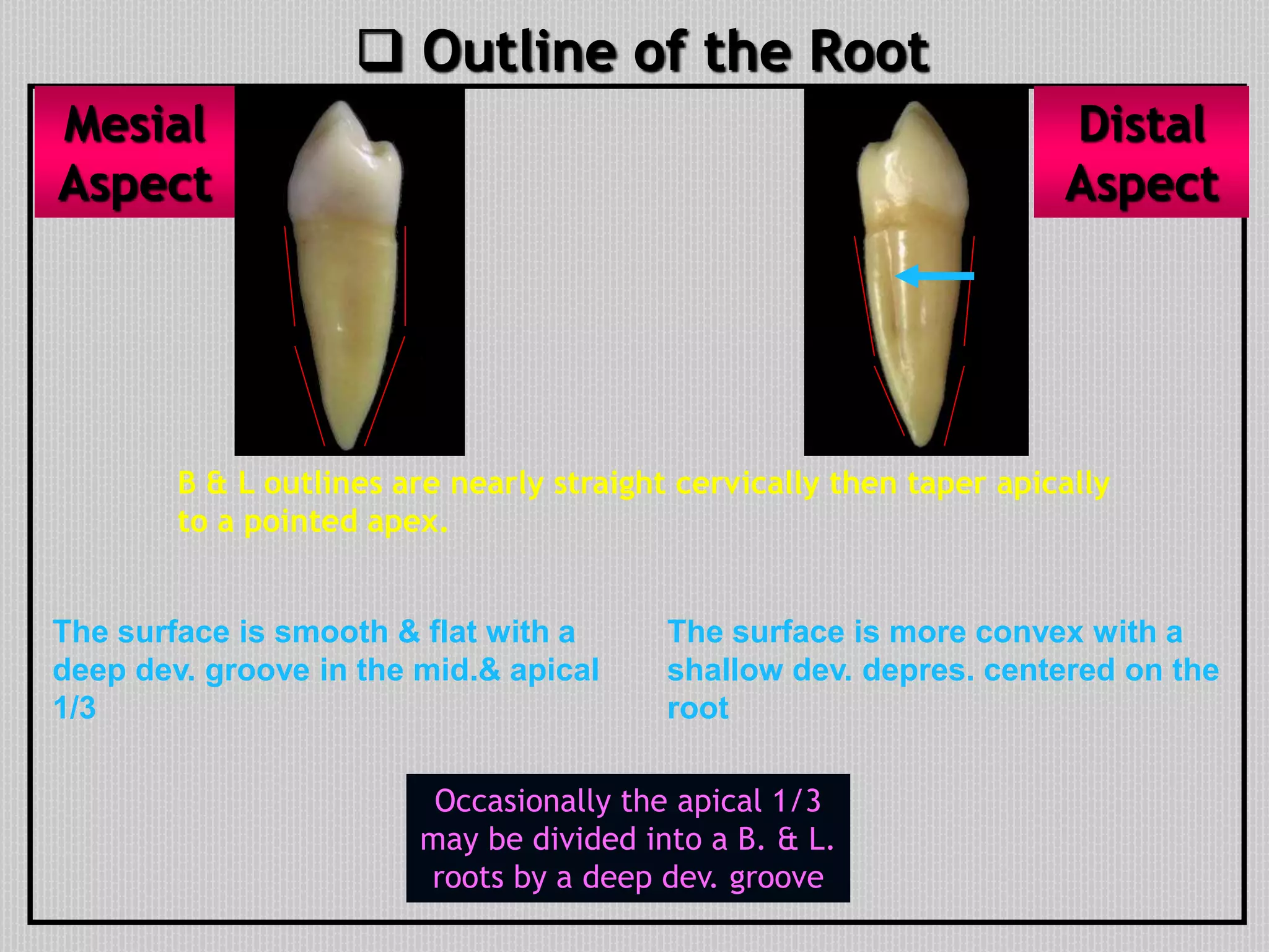  Outline of the Root
B & L outlines are nearly straight cervically then taper apically
to a pointed apex.
The surface is more convex with a
shallow dev. depres. centered on the
root
The surface is smooth & flat with a
deep dev. groove in the mid.& apical
1/3
Mesial
Aspect
Distal
Aspect
Occasionally the apical 1/3
may be divided into a B. & L.
roots by a deep dev. groove
 