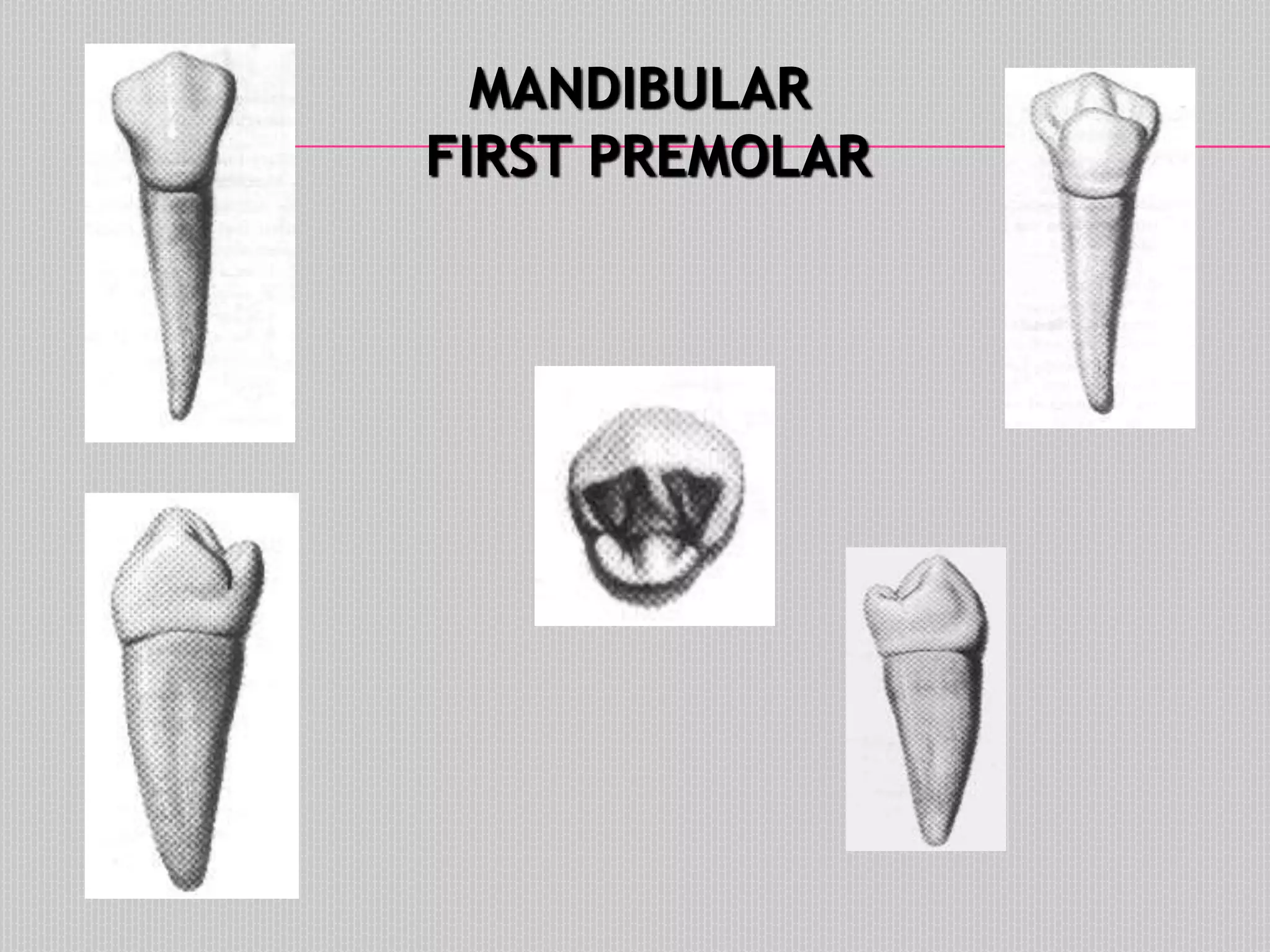 MANDIBULAR
FIRST PREMOLAR
 