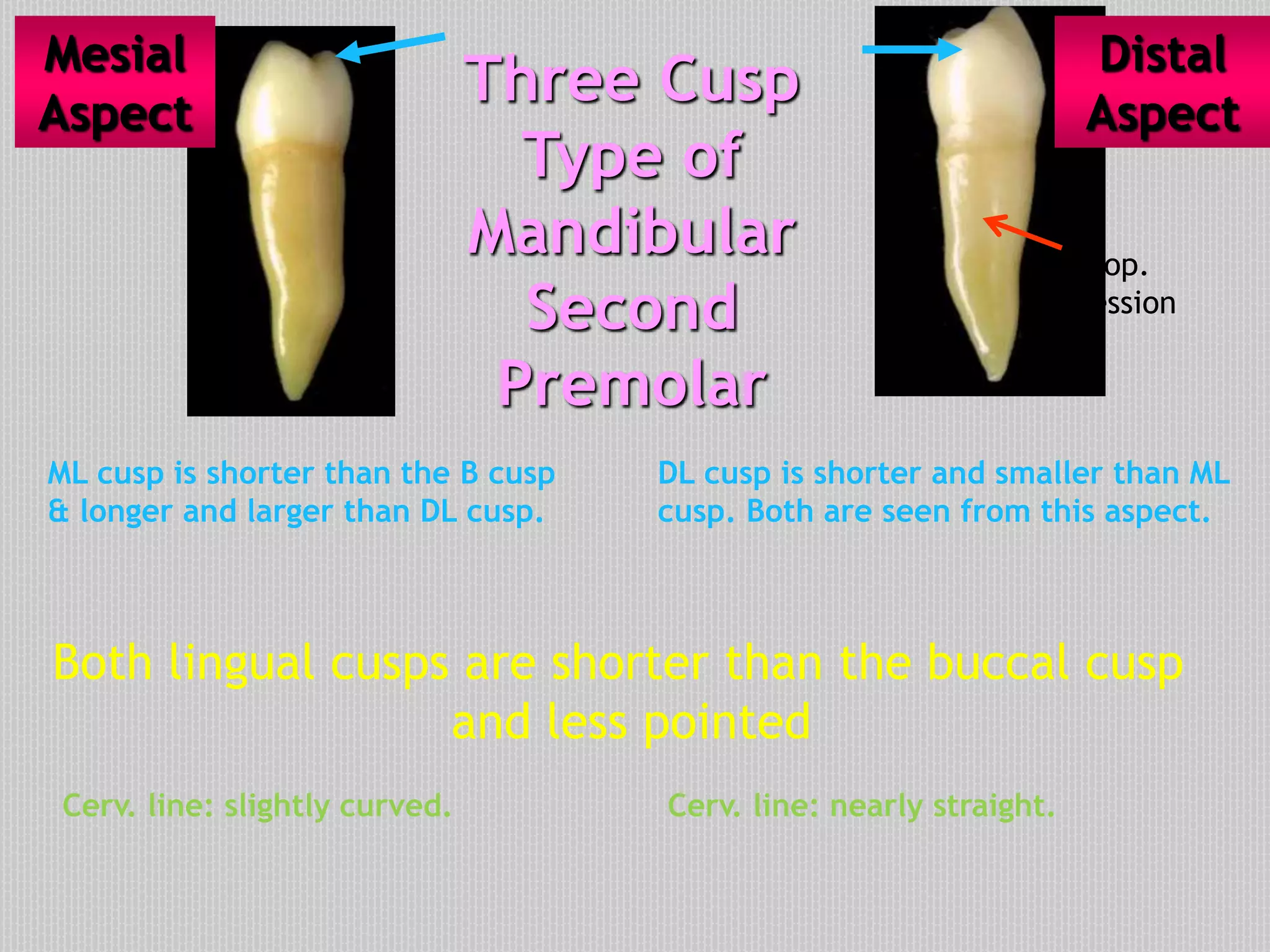 Three Cusp
Type of
Mandibular
Second
Premolar
ML cusp is shorter than the B cusp
& longer and larger than DL cusp.
DL cusp is shorter and smaller than ML
cusp. Both are seen from this aspect.
Both lingual cusps are shorter than the buccal cusp
and less pointed
Mesial
Aspect
Distal
Aspect
Develop.
depression
Cerv. line: slightly curved. Cerv. line: nearly straight.
 