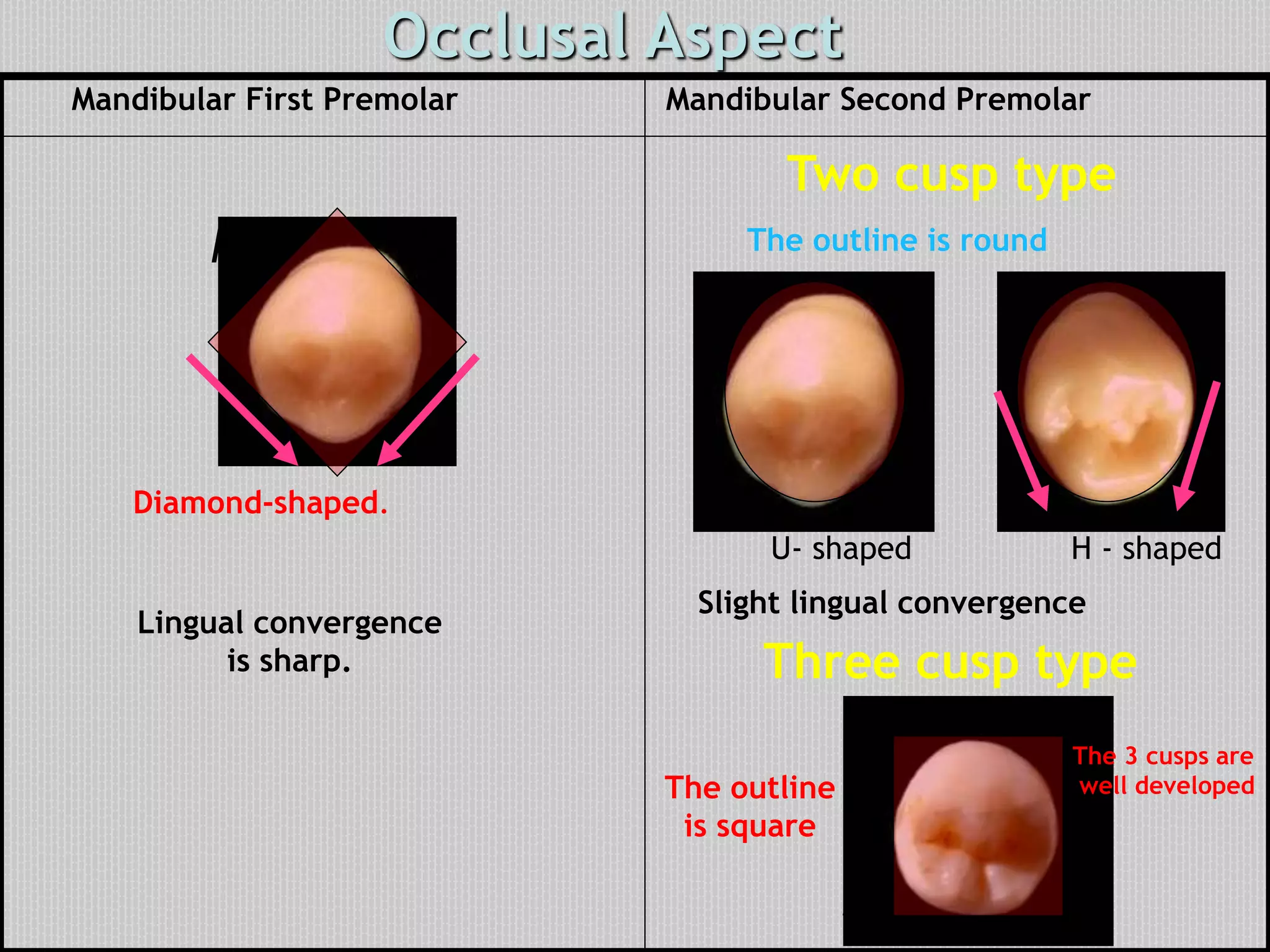 Occlusal Aspect
Two cusp type
Diamond-shaped.
Lingual convergence
is sharp.
The outline is round
Slight lingual convergence
Three cusp type
The outline
is square
Mandibular First Premolar Mandibular Second Premolar
U- shaped H - shaped
M D
The 3 cusps are
well developed
M D
 