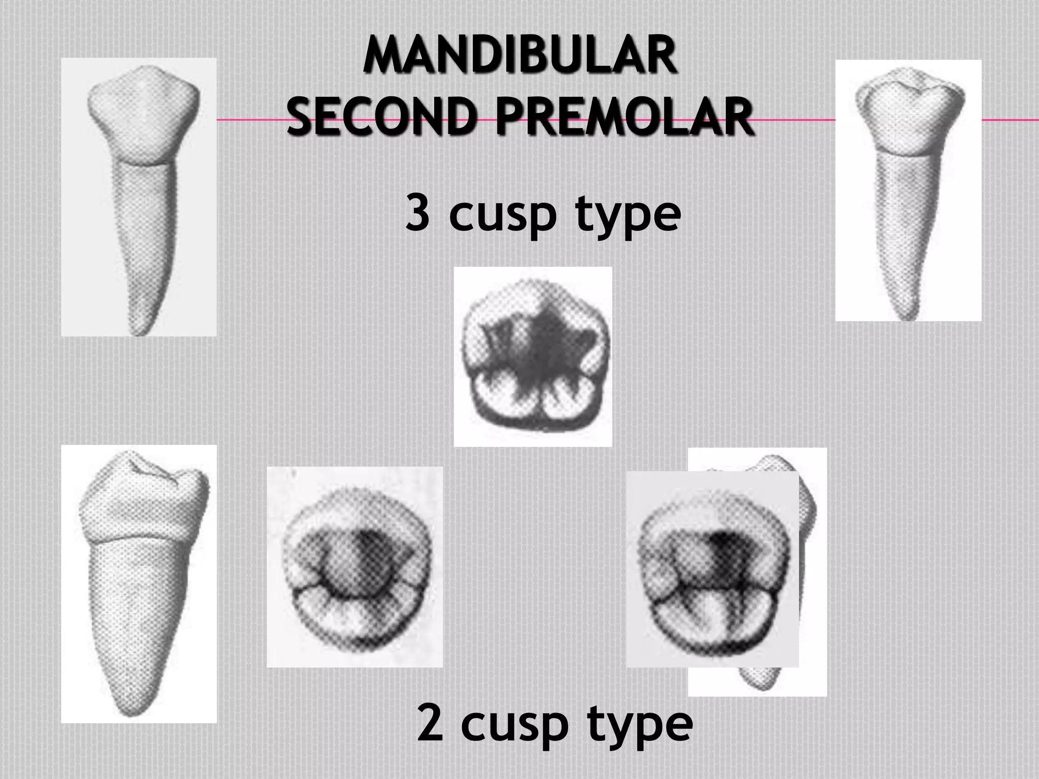 MANDIBULAR
SECOND PREMOLAR
3 cusp type
2 cusp type
 