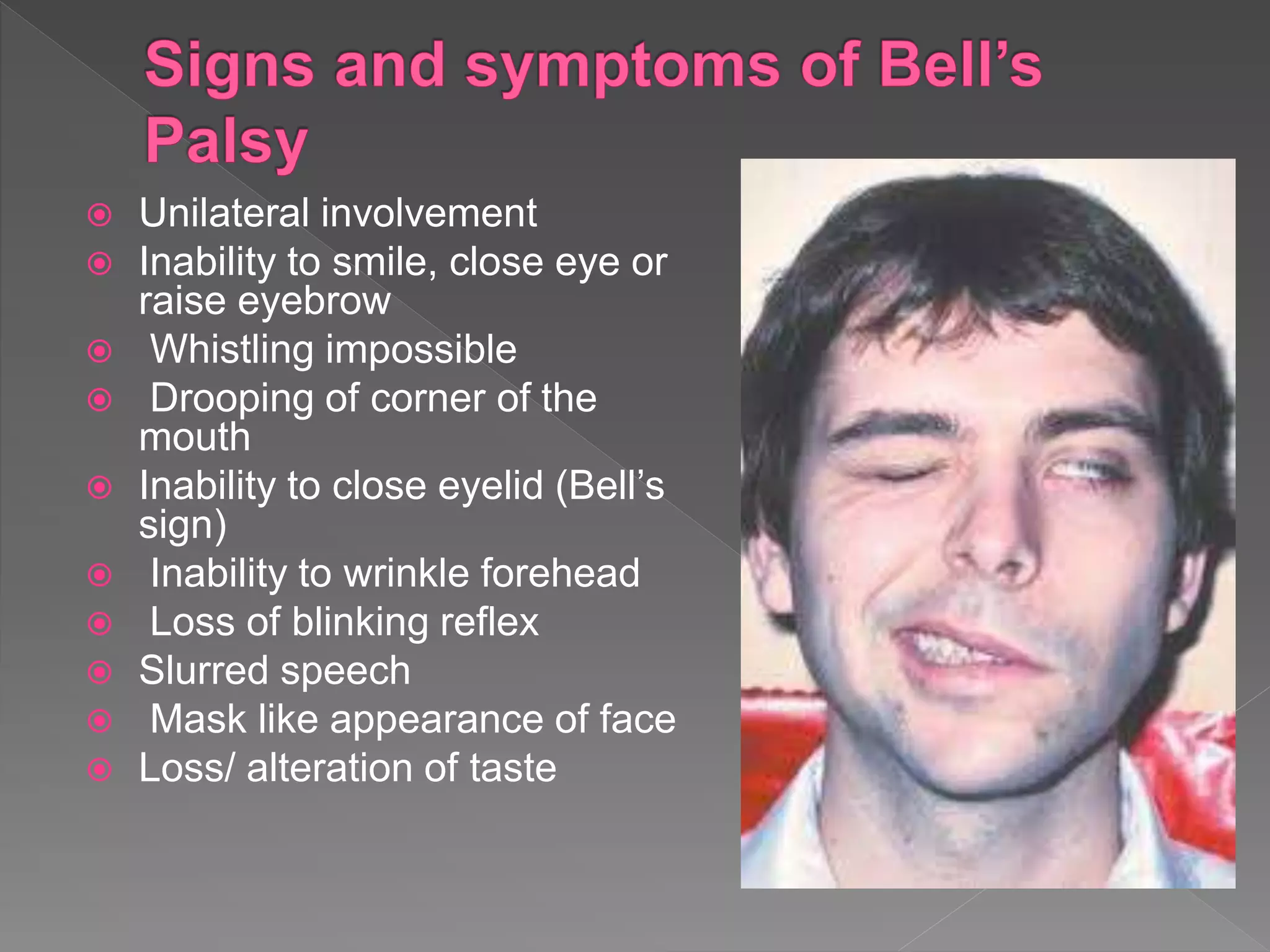 Bell's Reflex Applied surgical anatomy of facial nerve in oral and maxillofacial ...