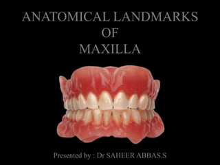 ANATOMICAL LANDMARKS
OF
MAXILLA
Presented by : Dr SAHEER ABBAS.S
 