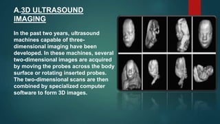 A.3D ULTRASOUND
IMAGING
In the past two years, ultrasound
machines capable of three-
dimensional imaging have been
developed. In these machines, several
two-dimensional images are acquired
by moving the probes across the body
surface or rotating inserted probes.
The two-dimensional scans are then
combined by specialized computer
software to form 3D images.
 