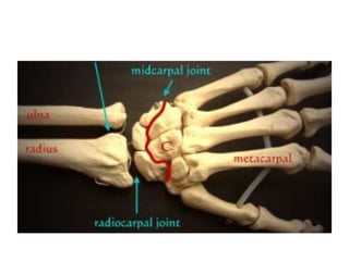 Wrist Multangular Joint Wrist Joint | PPTX