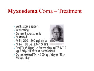 Myxoedema Coma – Treatment
 