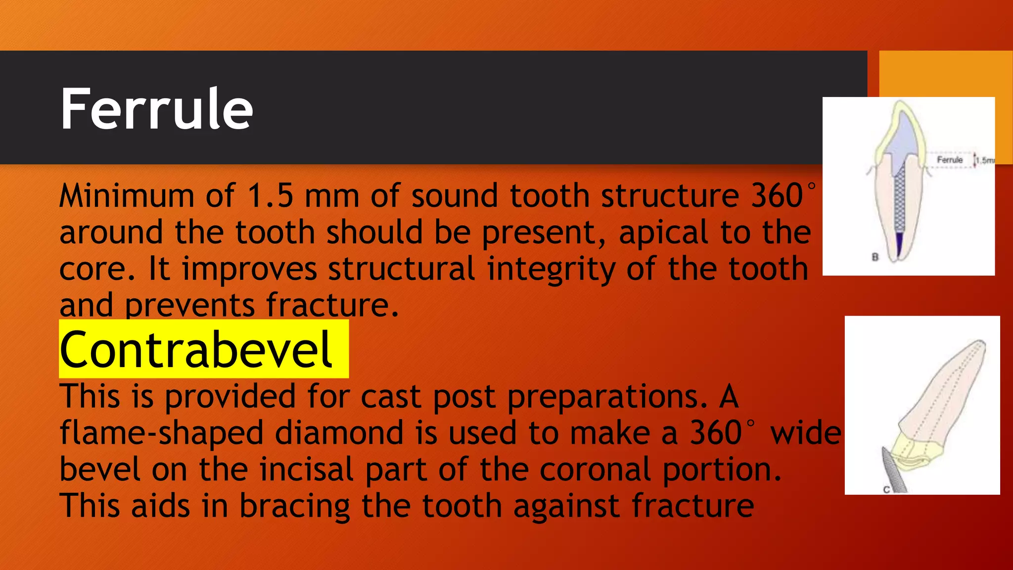 restoration of endodontically treated teeth in prosthodontics/ post and ...