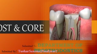 OST & CORE
Submitted To: DEPARTMENT OF
PROSTHODONTICS
Submitted By: TusharSaxena(Finalyear)
 