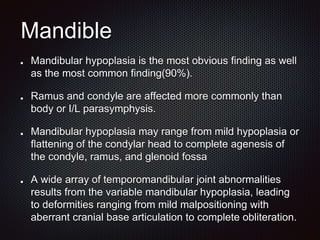 Mandible
Mandibular hypoplasia is the most obvious finding as well
as the most common finding(90%).
Ramus and condyle are affected more commonly than
body or I/L parasymphysis.
Mandibular hypoplasia may range from mild hypoplasia or
flattening of the condylar head to complete agenesis of
the condyle, ramus, and glenoid fossa
A wide array of temporomandibular joint abnormalities
results from the variable mandibular hypoplasia, leading
to deformities ranging from mild malpositioning with
aberrant cranial base articulation to complete obliteration.
 