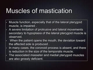 Muscles of mastication
• Muscle function, especially that of the lateral pterygoid
muscle, is impaired .
• A severe limitation of protrusive and lateral movements
secondary to hypoplasia of the lateral pterygoid muscle is
observed.
• When the patient opens the mouth, the deviation toward
the affected side is produced .
• In many cases, the coronoid process is absent, and there
is reduction in the size of the temporalis muscle.
• The associated masseter and medial pterygoid muscles
are also grossly deficient.
 