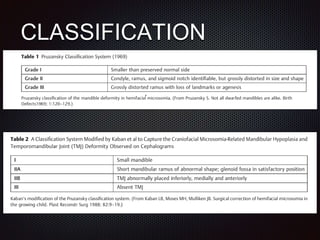 CLASSIFICATION
 