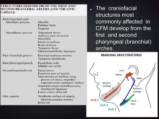 The craniofacial
structures most
commonly affected in
CFM develop from the
first and second
pharyngeal (branchial)
arches.
 