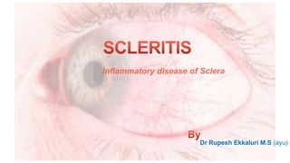Dr Rupesh Ekkaluri M.S (ayu)
Inflammatory disease of Sclera
 