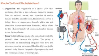 • Oxygenator: The oxygenator is a crucial part that
performs roles like a gas exchange, taking in oxygen
from an external source, and expulsion of carbon
dioxide from the patient's blood. It comprises a series of
hollow fibers or membranes through which gas and
blood flow in counter-current directions, which allows
for the efficient transfer of oxygen and carbon dioxide
across the membrane.
What Are The Parts Of The Artificial Lungs?
• Pump: Artificial lungs consist of a pump to circulate the
patient's blood through the system. The pump is
responsible for maintaining adequate blood flow and
pressure, ensuring oxygenated blood is delivered to the
patient's body. Several categories of pumps can be used,
like centrifugal pumps or roller pumps.
 