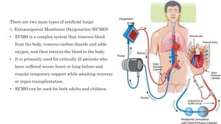 There are two main types of artificial lungs:
1. Extracorporeal Membrane Oxygenation (ECMO):
• ECMO is a complex system that removes blood
from the body, removes carbon dioxide and adds
oxygen, and then returns the blood to the body.
• It is primarily used for critically ill patients who
have suffered severe heart or lung failure and
require temporary support while awaiting recovery
or organ transplantation.
• ECMO can be used for both adults and children.
 