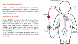 What does ECMO stand for?
ECMO stands for extracorporeal membrane
oxygenation. Extracorporeal means “outside the
body.” The rest of the name refers to getting oxygen
to your body’s cells.
How does ECMO work?
During ECMO treatment, blood flows out of your
body through a tube in a large blood vessel in your
chest, near your groin or in your neck. A pump
pushes your blood through tubes that carry it to a
machine that adds oxygen and removes carbon
dioxide. Then the machine pumps your blood back
into your body.
ECMO treatment helps people who need support for
their lungs, but it can also bypass both your heart
and lungs.
 