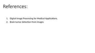 References:
1. Digital Image Processing for Medical Applications.
2. Brain tumor detection from images
 