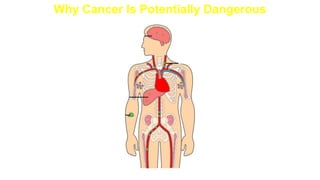 Why Cancer Is Potentially Dangerous
Melanoma
cells travel
through
bloodstream
Melanoma
(initial tumor)
Brain
Liver
 