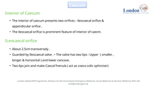 Abdominal Anatomy for MRCEM PRIMARY EXAM | PPTX