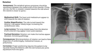 Comprehensive X-Ray Positioning Techniques for Thorax, Upper Airways ...