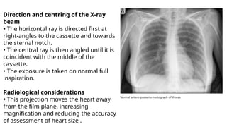 Comprehensive X-Ray Positioning Techniques for Thorax, Upper Airways ...