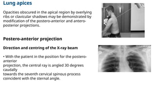 Comprehensive X-Ray Positioning Techniques for Thorax, Upper Airways ...