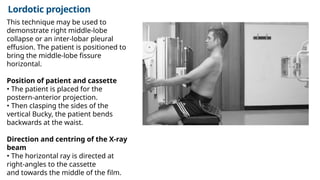 Comprehensive X-Ray Positioning Techniques for Thorax, Upper Airways ...