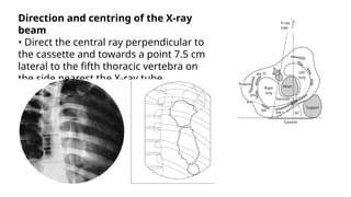 Comprehensive X-Ray Positioning Techniques for Thorax, Upper Airways ...