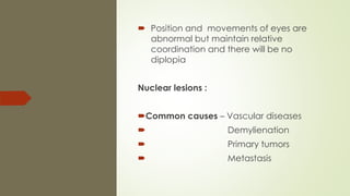  Position and movements of eyes are
abnormal but maintain relative
coordination and there will be no
diplopia
Nuclear lesions :
Common causes – Vascular diseases
 Demylienation
 Primary tumors
 Metastasis
 