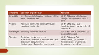 Syndrome Location of pathology Features
Benedikts At intermediate level of midbrain at the
level of red nucleus
I/L 3rd CN.palsy with tremors
and jerky movements on C/L
side
Webers Fasicular part while passing through
cerebral peduncle
I/L 3rd CN.palsy , C/L
hemiplegia and facial palsy of
UMN type
Nothnagel
s
Involving midbrain tectum U/L or B/L 3rd CN.palsy and I/L
cerebellar ataxia
Claudes Brainstem stroke syndrome
Affects oculomotor N.,red nucleus and
brachium conjunctivum
Nothnagels + Benedikts syndromes
I/L 3rd CN.palsy,C/L
hemiparesis,C/L ataxia,C/L
hemiplegia of lower face ,
tongue and shoulder
 