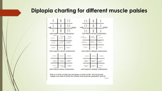 Diplopia charting for different muscle palsies
 