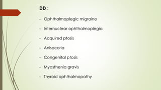 DD :
- Ophthalmoplegic migraine
- Internuclear ophthalmoplegia
- Acquired ptosis
- Anisocoria
- Congenital ptosis
- Myasthenia gravis
- Thyroid ophthalmopathy
 