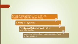 Inverse duane syndrome – MR to LPS – lid
retracts when patient adducts his eye
2. Pupil gaze dyskinesis :
Pseudo Argyl Robertson pupil – MR to
sphincter pupillae
More pupil constriction to convergence than
to light response
 