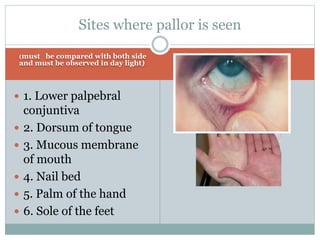 GENERAL PHYSICAL EXAMINATION | PPTX