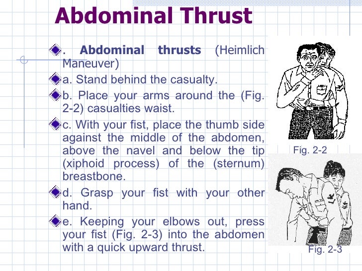 Presentation 2 General