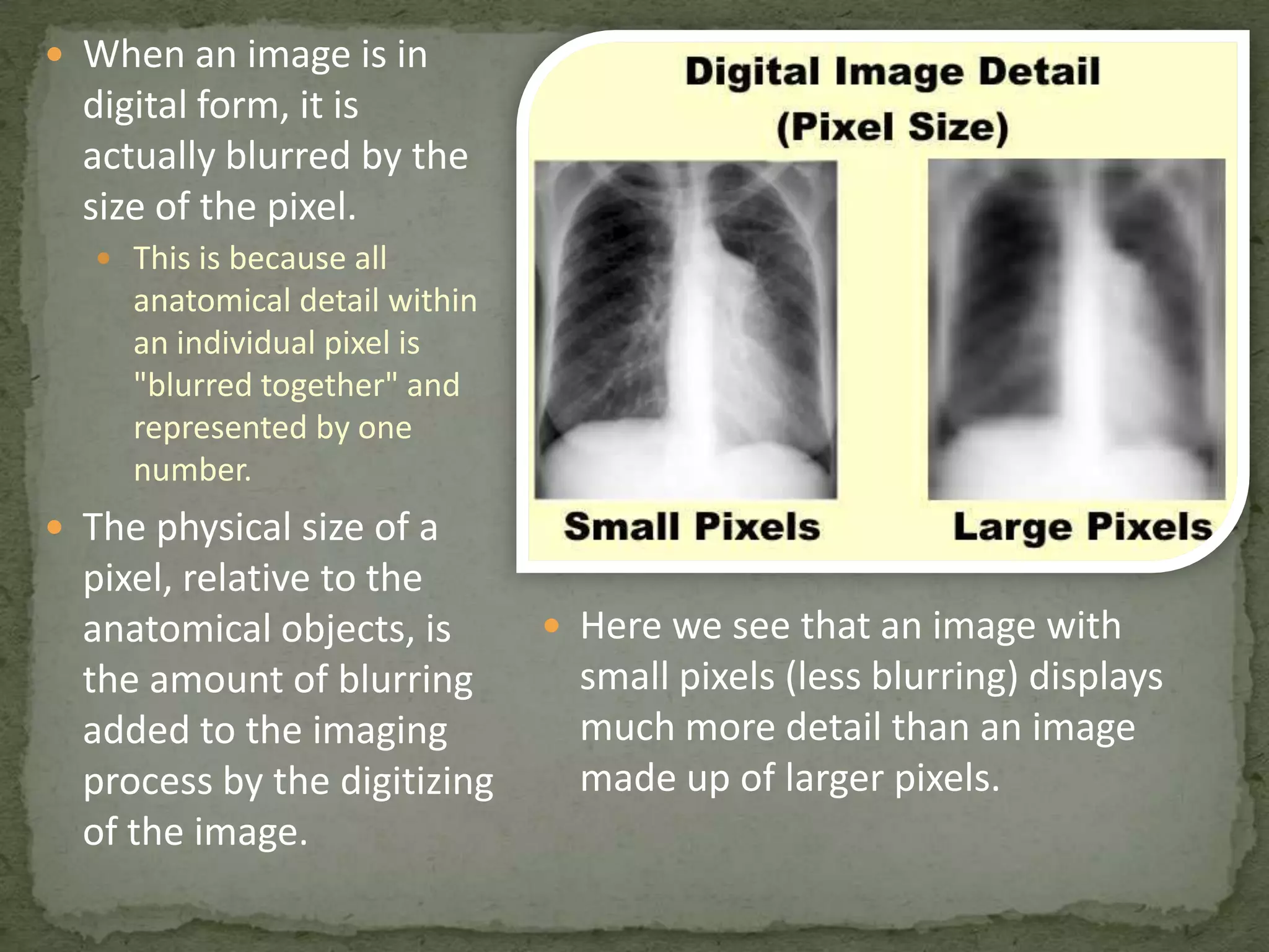  When an image is in

digital form, it is
actually blurred by the
size of the pixel.
 This is because all

anatomical detail within
an individual pixel is
"blurred together" and
represented by one
number.

 The physical size of a

pixel, relative to the
anatomical objects, is
the amount of blurring
added to the imaging
process by the digitizing
of the image.

 Here we see that an image with

small pixels (less blurring) displays
much more detail than an image
made up of larger pixels.

 