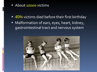 About 10000 victims 40 % victims died before their first birthday Malformation of ears, eyes, heart, kidney, gastrointestinal tract and nervous system