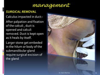 management
SURGICAL REMOVAL
Calculus impacted in duct:-
After palpation and fixation
of the calculi , duct is
opened and c...