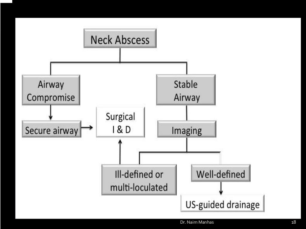 deep neck space infections