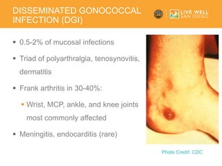 Sexually Transmitted Diseases Update | PDF