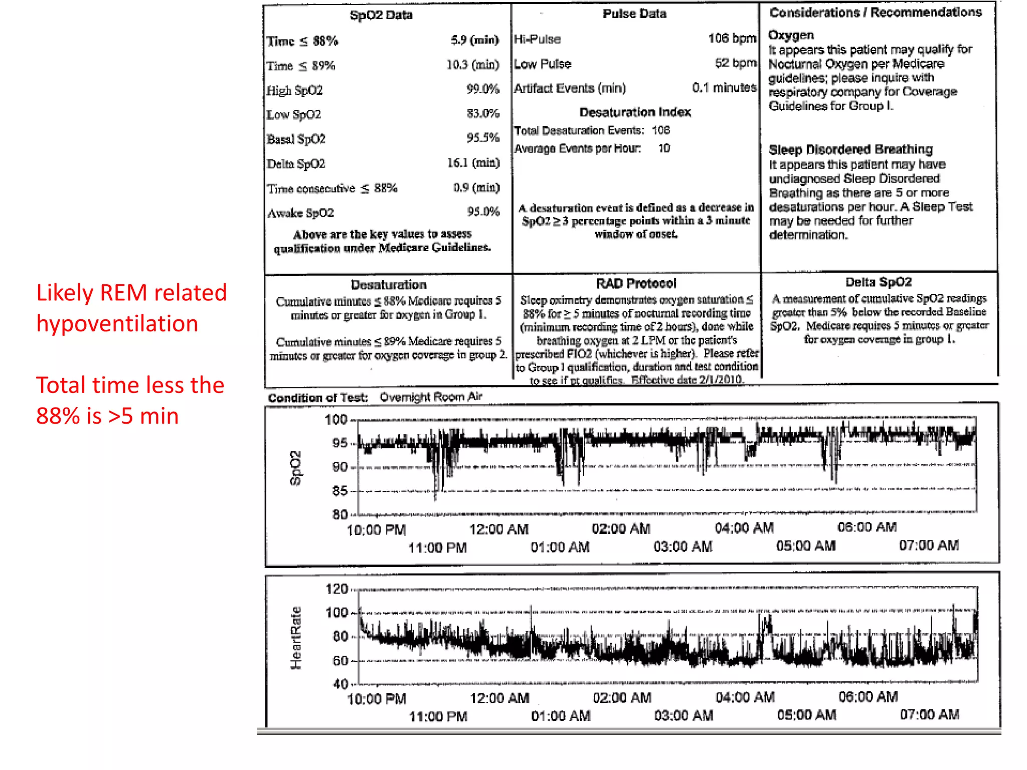 Likely REM related 
hypoventilation 
Total time less the 
88% is >5 min 
 