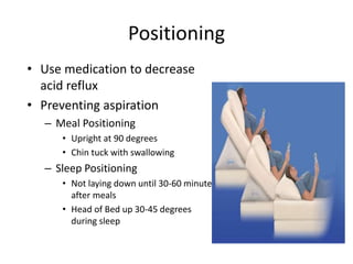 Positioning 
• Use medication to decrease 
acid reflux 
• Preventing aspiration 
– Meal Positioning 
• Upright at 90 degrees 
• Chin tuck with swallowing 
– Sleep Positioning 
• Not laying down until 30-60 minutes 
after meals 
• Head of Bed up 30-45 degrees 
during sleep 
 