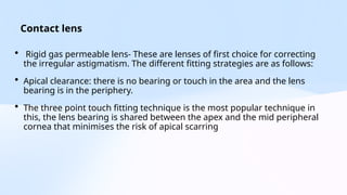 Presentation 2 (1).ketatoconus ppt and pptx | PPTX